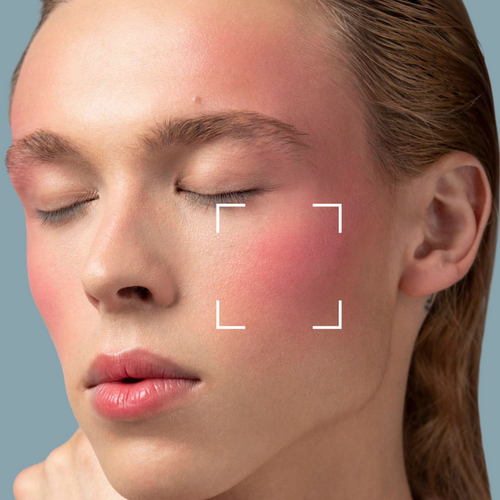 Sensitive Skin