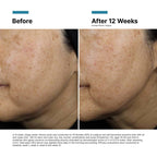 A.G.E. Interrupter Ultra Serum